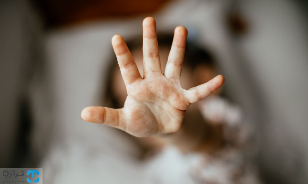 جرم تهمت زدن چیست و چه مجازاتی دارد؟