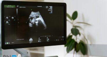 سامانه گزارش سقط جنین